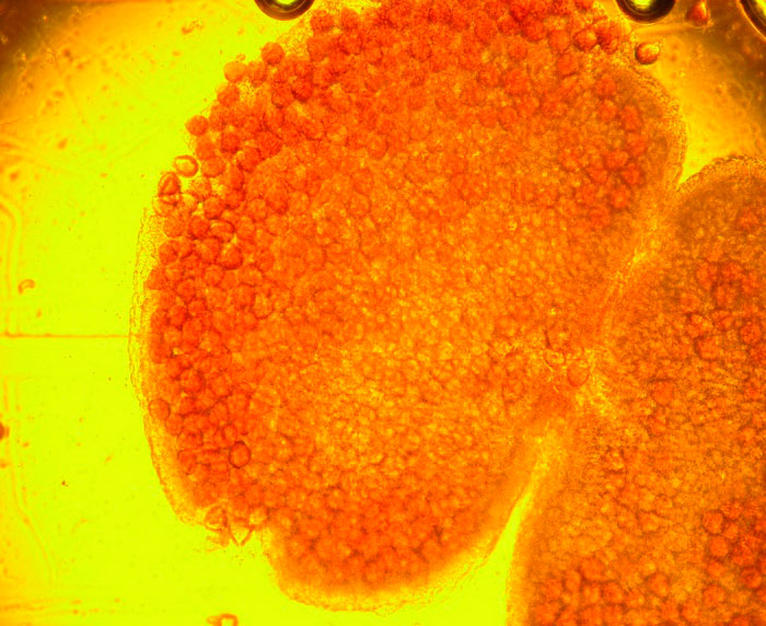 Растрескивающийся пыльник сорта алычи Асалода. Исследования Института плодоводства 2015